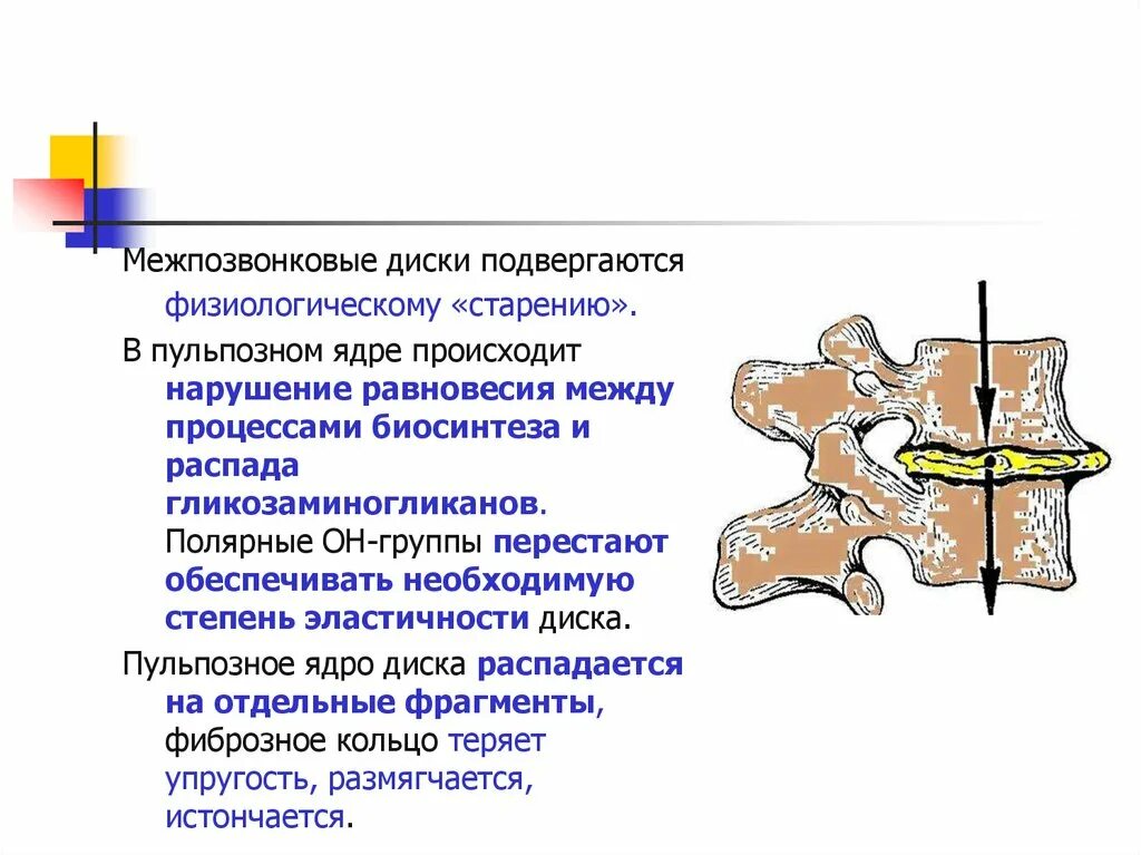 Ядер диск. Пульпозное ядро диска. пульпозные ядра межпозвоночных дисков. пульпозное ядро межпозвоночного диска. давление в межпозвонковых дисках.