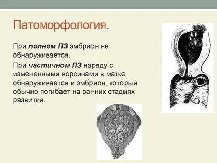 Зародыш не содержит