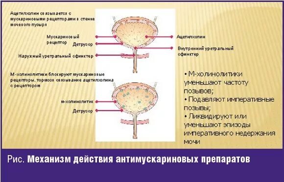 Наполненный мочевой пузырь. Недержание мочи. Позывы мочевого пузыря. Императивные позывы к мочеиспусканию. Гиперреактивный мочевой пузырь.