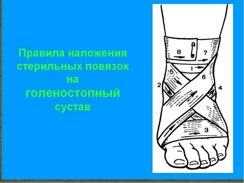 8 на голеностопный сустав. Повящка восьмёрка на голеностопный сустав. Десмургия повязка восьмиобразная на голеностопный сустав. Наложение бинтовой повязки на голеностопный сустав. Повязка на голеностопный сустав восьмиобразная техника наложения.