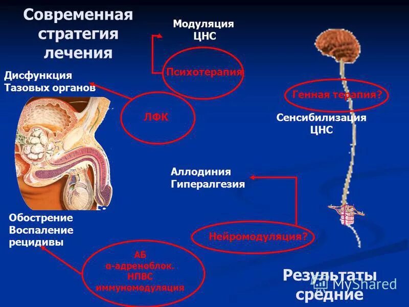 Хроническая тазовая боль у мужчин