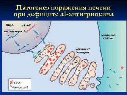 Дефицит альфа 1