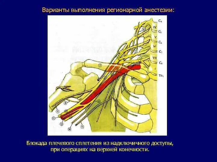 Блокада сплетения. Методика блокады плечевого сплетения межлестничным доступом. Блокада шейного сплетения межлестничным доступом. Блокада плечевого сплетения по Куленкампфу. Протокол блокады плечевого сплетения.