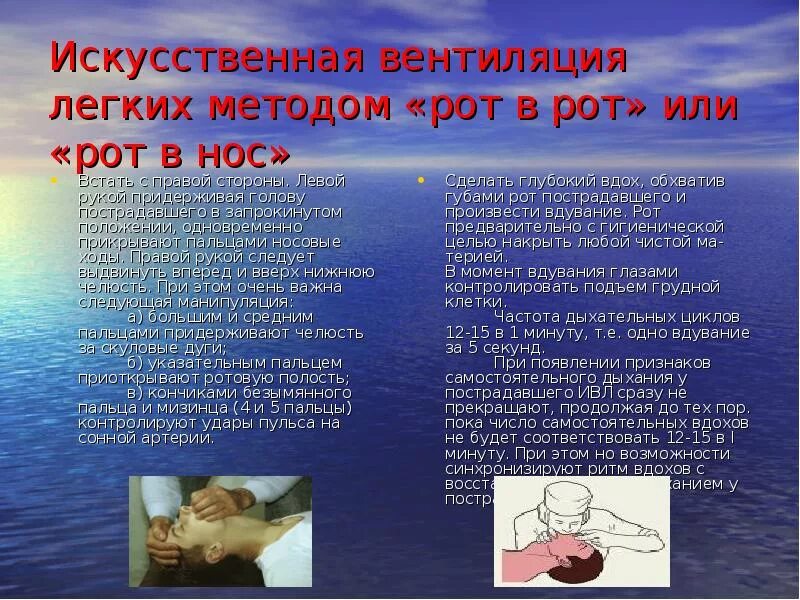 Искуственная вентиляция легких алгоритм кратко. Искусственная вентиляция лёгких алгоритм. Искусственная вентиляция легких методом ‘’рот в нос’’.