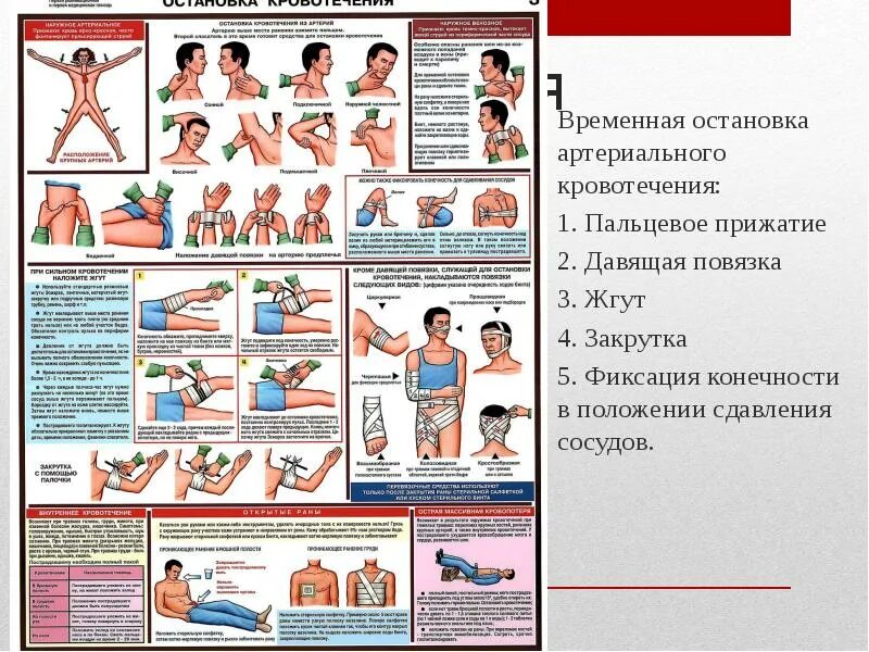 Порядок действий при остановке артериального. Порядок действий при остановке артериального. Способы остановки артериального кровотечения. Способы временного гемостаза. Артериальное кровотечение из сосудов верхних и нижних конечностей.
