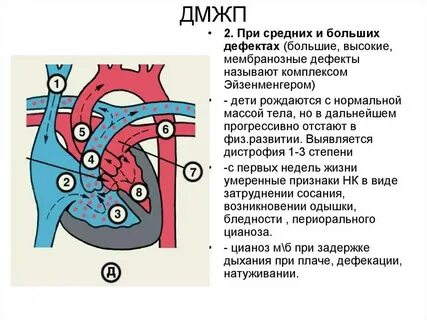 Дмжп у новорожденных