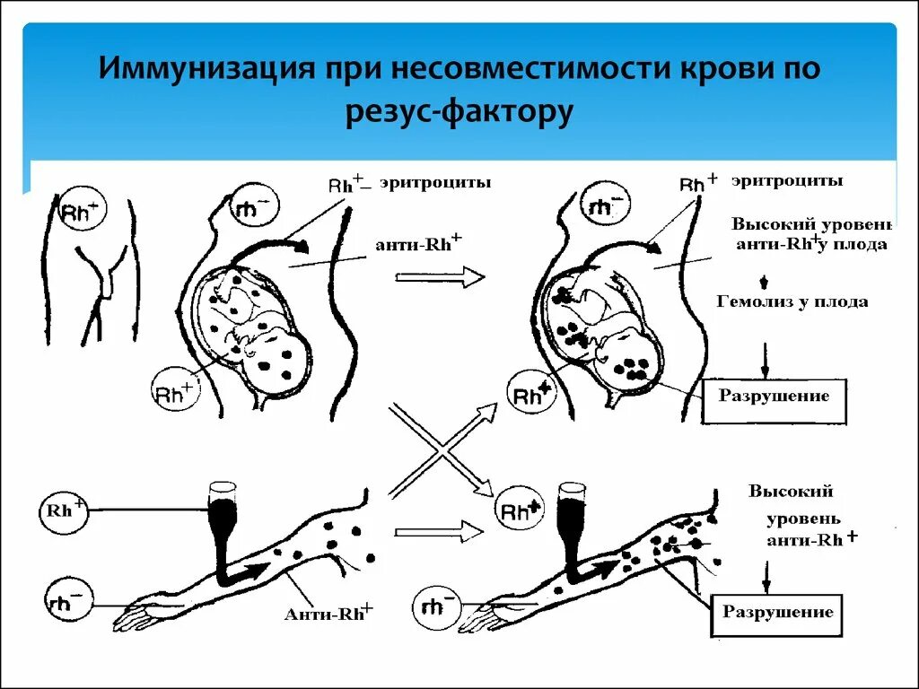 Профилактика резус несовместимости. Профилактика резус-иммунизации.. Пути иммунизации по резус-фактору. Пути иммунизации резус антигеном. Резус прививка