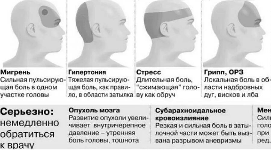 При нагрузке болит голова. Головная боль. При головной боли. Типы головной боли. Головная боль схема.