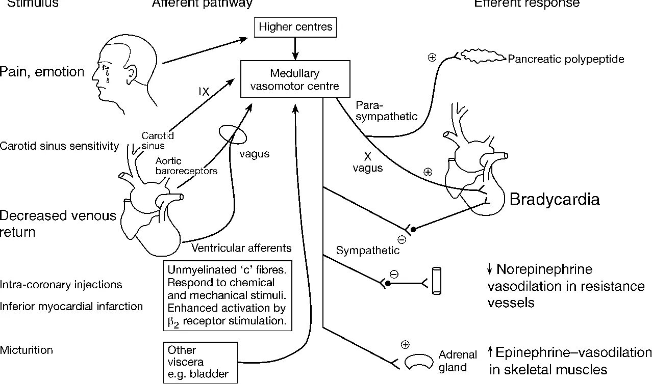 Рефлекс Бецольда Яриша. Эфферентное влияние рефлекса Бецольда-Яриша:. Bezold-Jarisch синдром. Рефлекторная брадикардия.