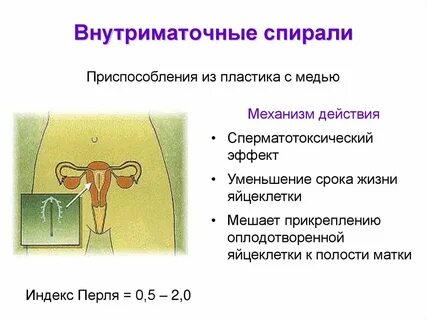 Спираль виды какую выбрать