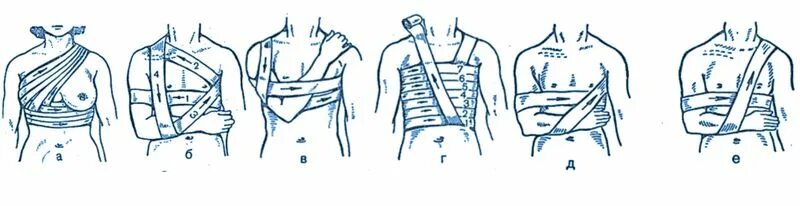 Наложение повязки Дезо алгоритм. Повязка Дезо алгоритм. Накладывание повязки Дезо алгоритм. Наложить повязку Дезо алгоритм.