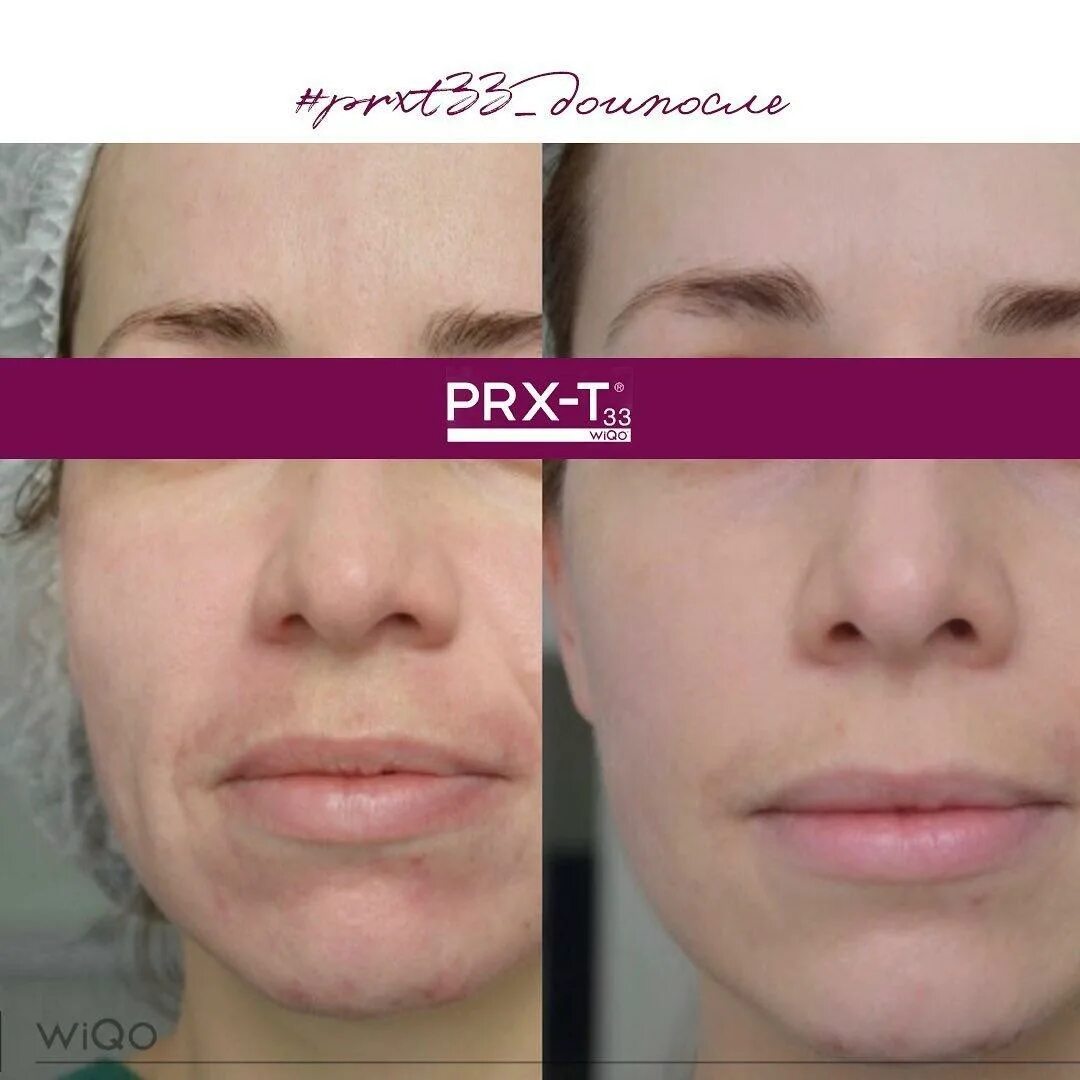 Proline pr-a3404s. видеорегистратор proline pr-x2216d. видеорегистратор на 4 канала proline pr-x2004ak. Proline pr-x2216m. Proline pr-a3404s.