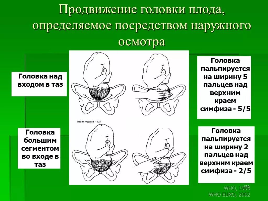 Положения головки плода. Положение головки плода. Головка во входе в малый таз. Головка над входом в таз определить. Положение головки плода в плоскости входа.