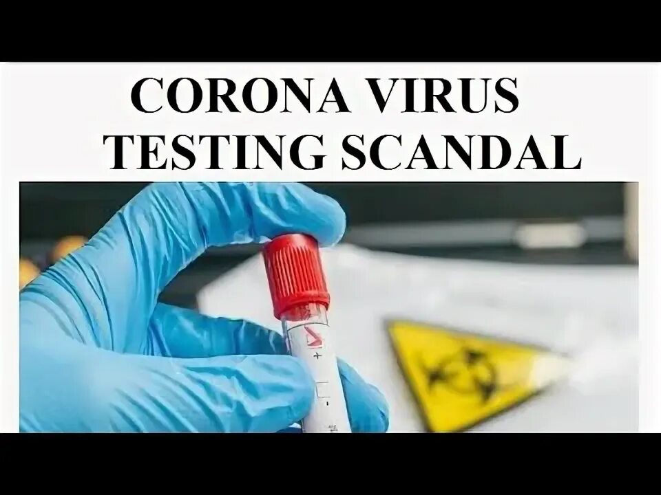 Virus testing. Коронавирус. coronavirus.