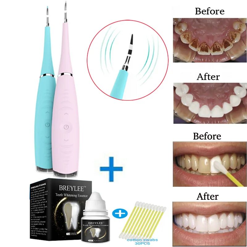 Зубной камень инструмент. Ультразвуковая зубная щетка для удаления зубного камня. Стоматологические приспособления. Скалер для зубов домашний.