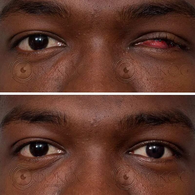 адреса глазного протезирования