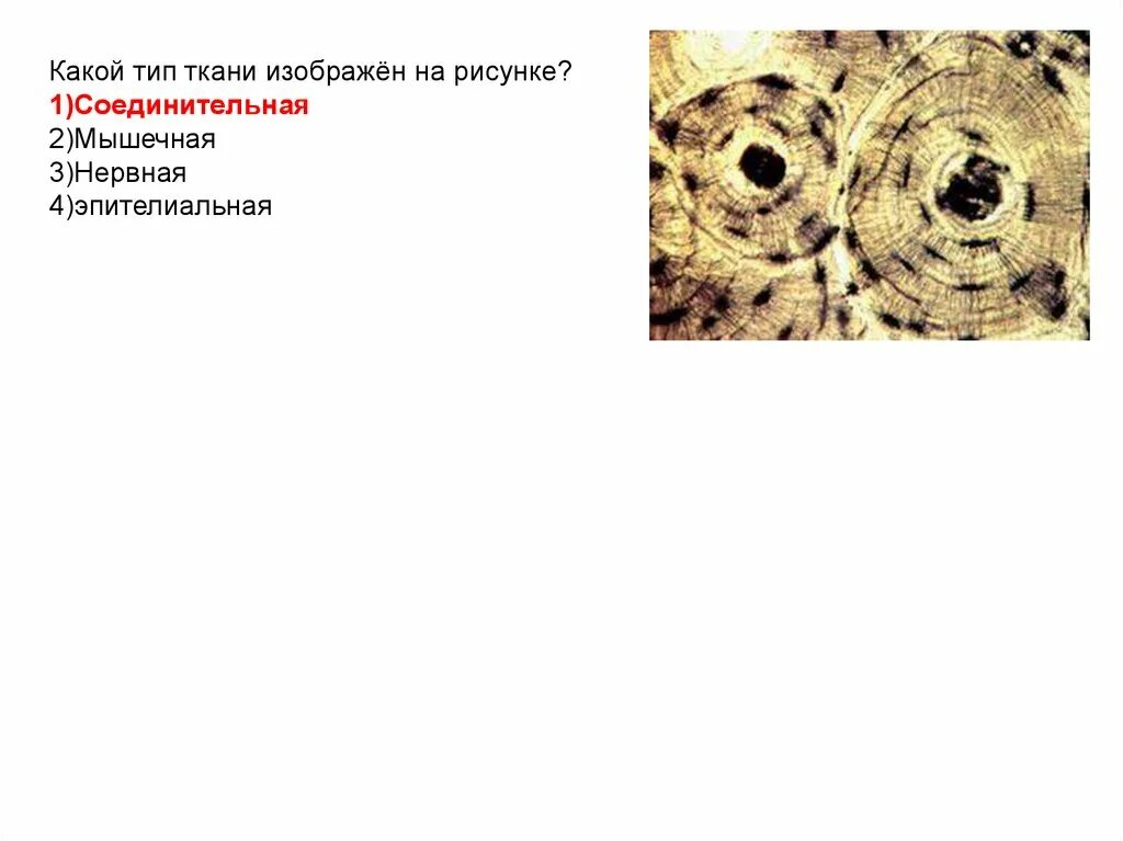 Какому типу ткани относится. Ткань 1)  соединительная 2)  эпителиальная. Какие виды соединительных тканей изображены на рисунке. Ткани эпителиальная соединительная мышечная нервная. Какие ткани изображены на картинке.