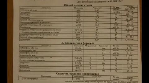Анализ прививки