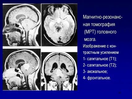 Лучевая диагностика реферат
