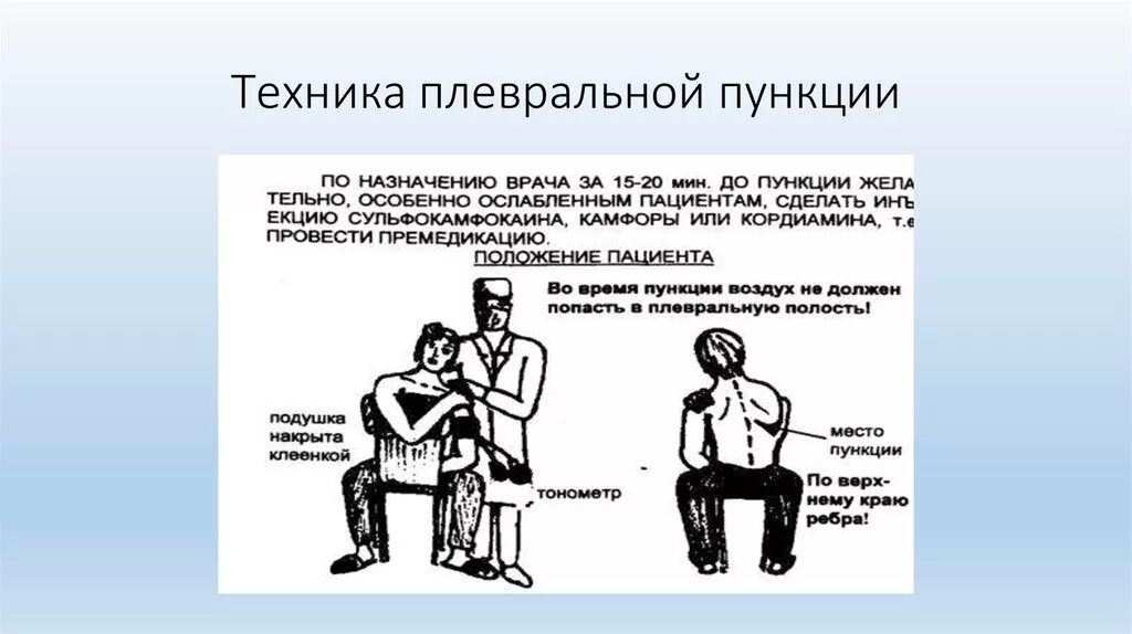 Техника выполнения плевральной пункции. Методика плевральной пункции. Плевральная пункция техника. Положение пациента при плевральной пункции.