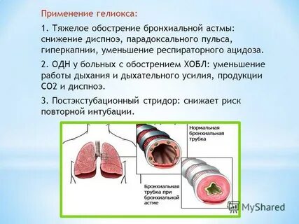 Тяжелое обострение бронхиальной астмы