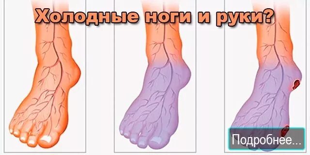 Утром холодные ноги