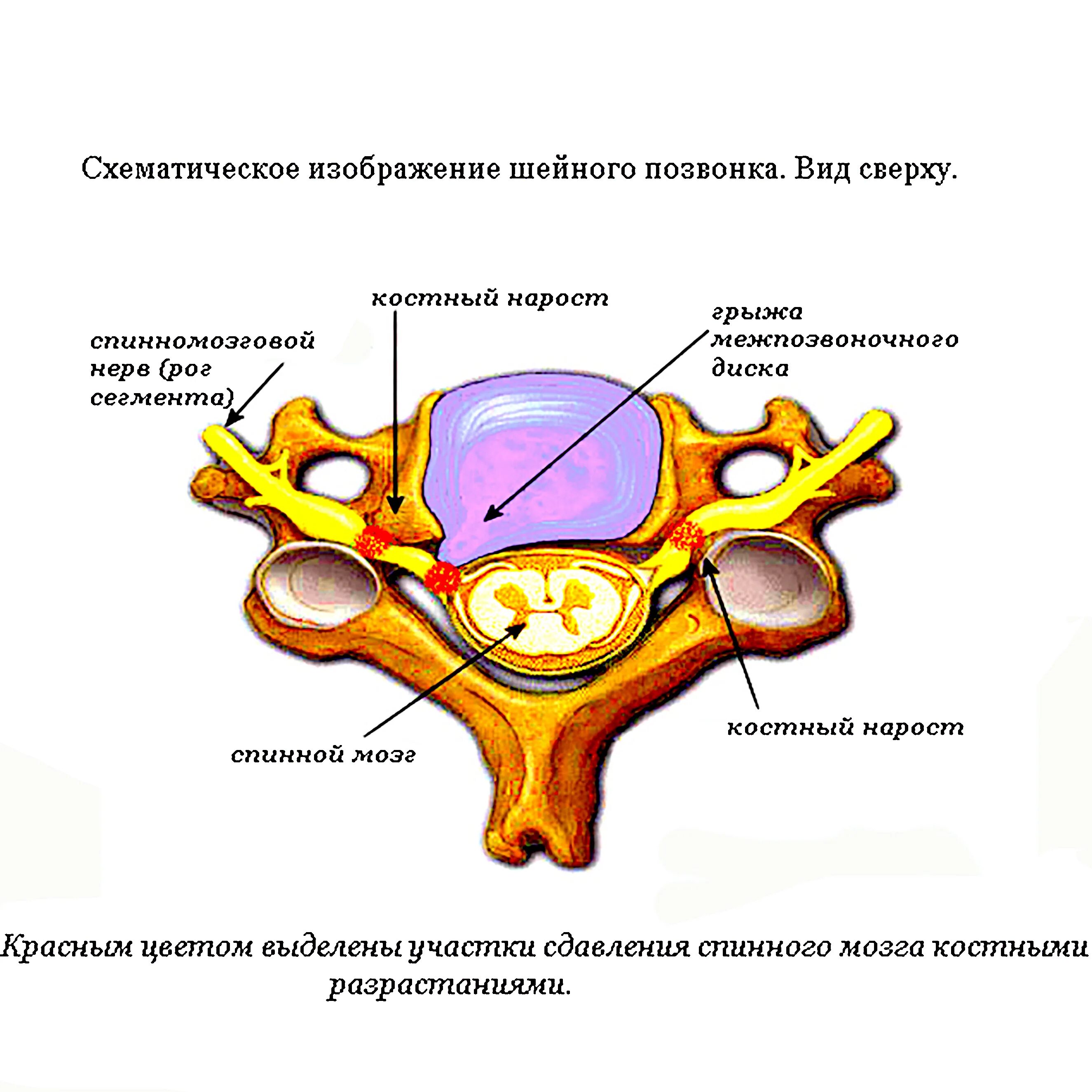 Тело позвонка размер. С5 позвонок строение. Строение шейного позвонка человека анатомия. 7 Шейный позвонок строение. Шейный позвонок в разрезе.