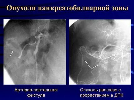 Симптом аномалия