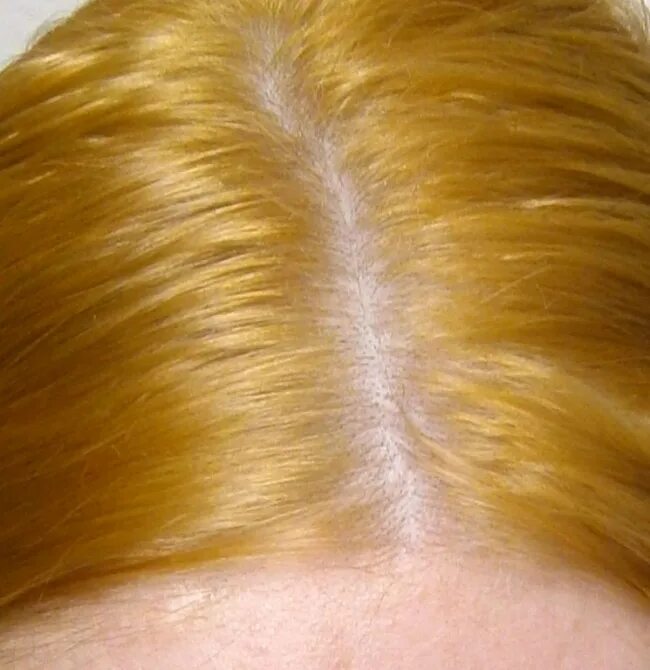 Желтый волос 2. Жёлтые волосы после осветления. Волосы после обесцвечения. Волосы после обесцвечивания. Осветленные волосы желтые.