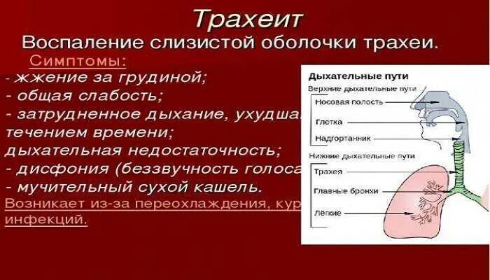 Трахеит эффективное лечение. Воспаление трахеи трахеит.