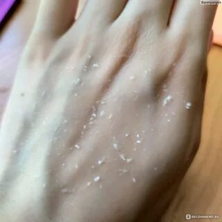 Почему сползает кожа