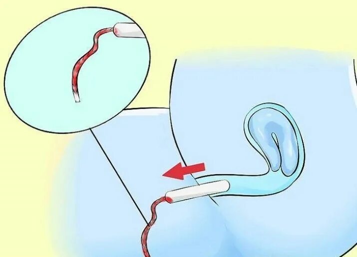 Вставка тампона. Куда вставлять тампон. Как всовывать тампон. Купание при месячных