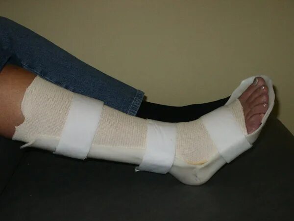 реабилитация при переломе лодыжки. реабилитация после эндопротезирования тбс. 2 месяца после перелома ноги. перелом позвоночника реабилитация. 2 месяца после перелома ноги.