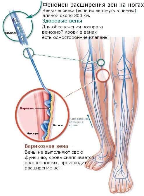 Клапан на ноге где находится Лодыжка ступни