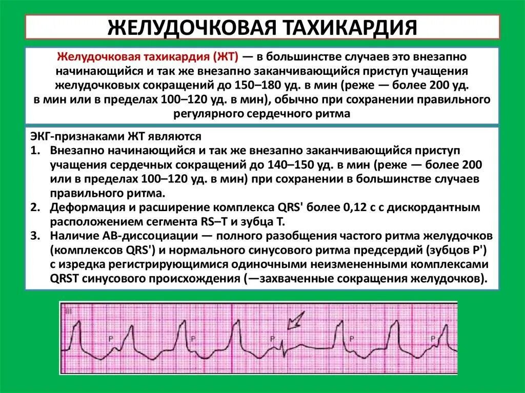 Сильное сердцебиение температура