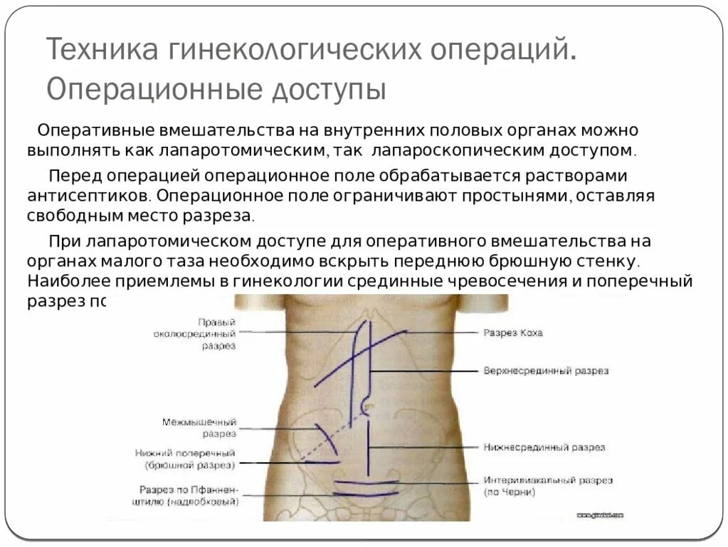 Бриться перед операцией. Виды разрезов при гинекологических операциях. Виды операционных доступов. Гинекологические операции доступ. Гинекология операционные доступы.