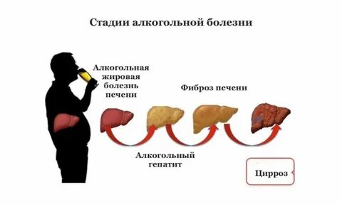 Стадии перед циррозом печени