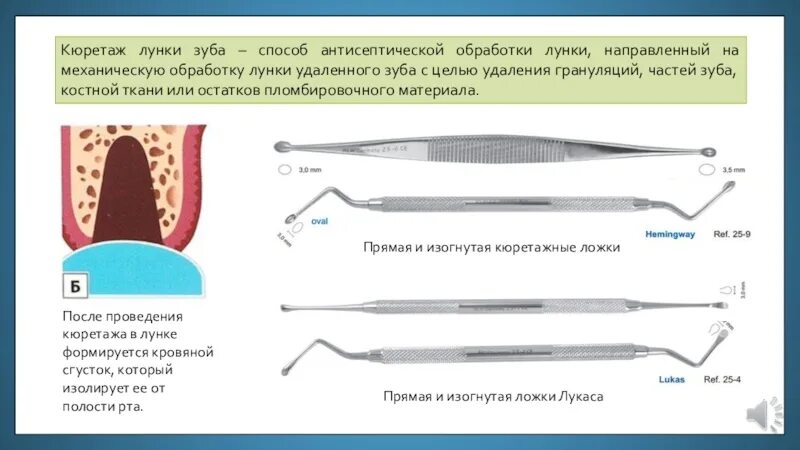 После удаления зуба через сколько убирать тампон. Кюретаж удаленного зуба. Кюретаж лунки удаленного зуба. Методика проведения кюретажа.