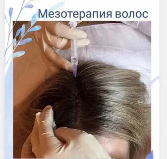 Мезотерапия ростов
