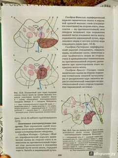 Триумфов неврология