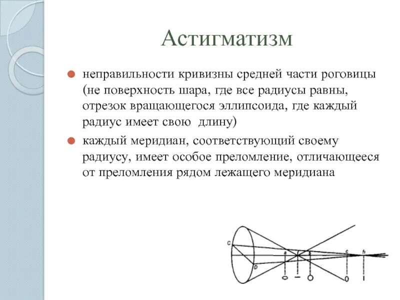 Гиперметропический астигматизм. Простой прямой гиперметропический астигматизм. Астигматизм гиперметропический сложной степени. Гиперметропический астигматизм это глаз. Сложный гиперметропический астигматизм глаз