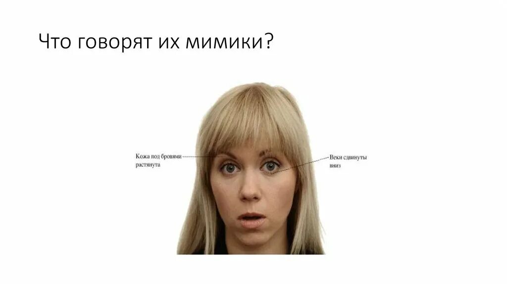 Мимика ревность прохождение. Тиреотоксикоз мимика лица. мимика лица при тиреотоксикозе. мимика лица спасибо за внимание. контактное лицо для презентации.