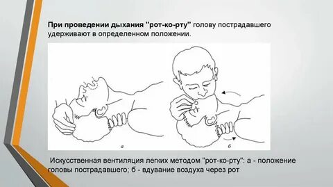 Какова оптимальная частота вдувания при искусственном дыхании