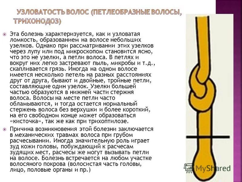 Узелки на волосах. Нина добрев размер. Хвост на голове прическа. Волосы в узел. Волосы завязываются в узелки.