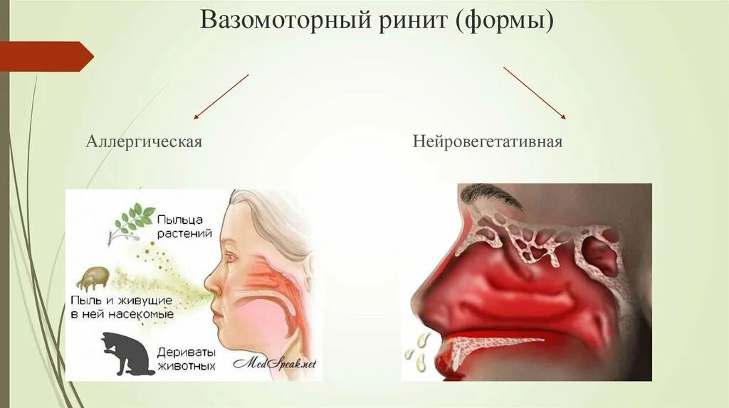 Аллергия нос не дышит что