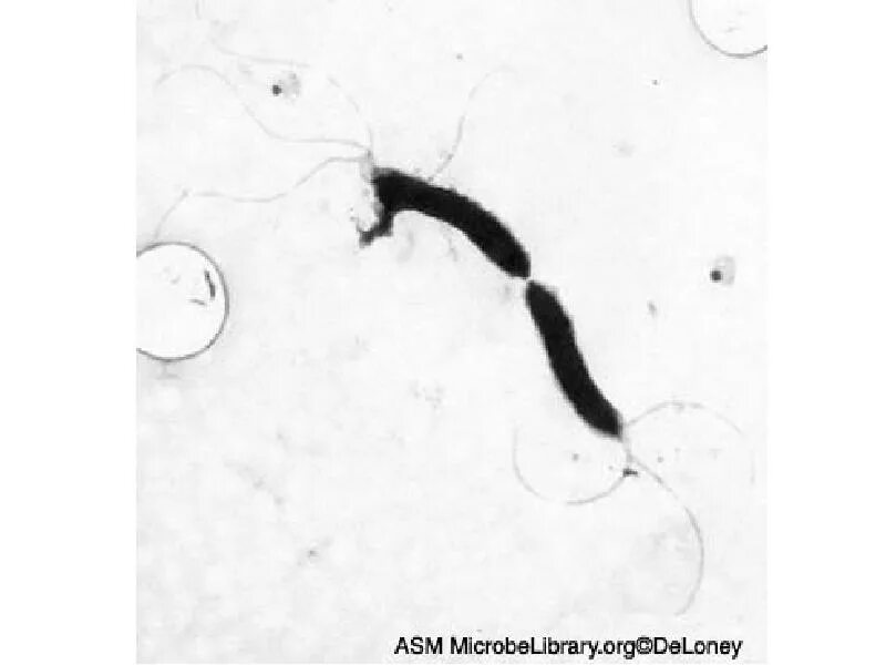 Определение хеликобактер в кале. Кампилобактерии хеликобактерии. Кампилобактер и хеликобактер. Кампилобактерии и хеликобактерии микробиология. 6) Кампилобактерии, хеликобактерии.