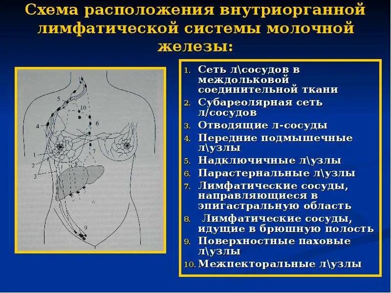 Парастернальные лимфатические узлы. Лимфатические узлы в эпигастрии. Лимфатический узел Зоргиуса. Зона Зоргиуса лимфатические узлы. Лимфоузлы при рмж