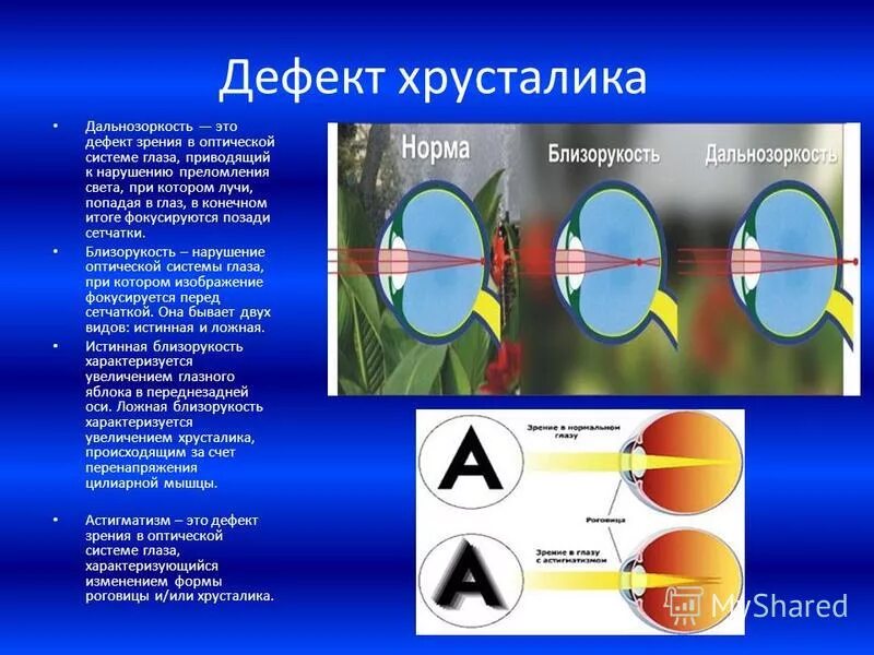 Дополните предложения изображение в близоруком глазу фокусируется