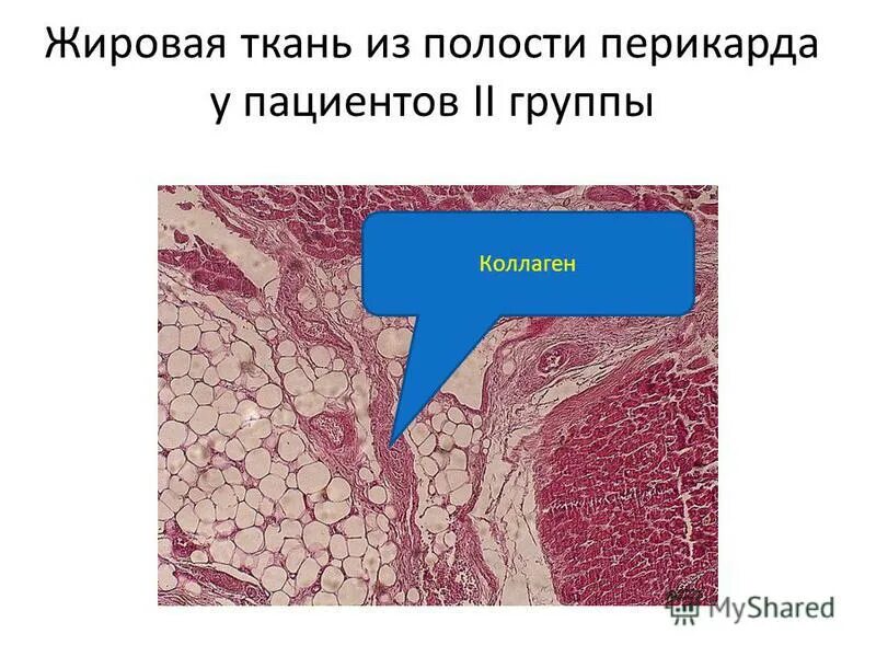 жировая ткань строение. изменение жировой ткани. возрастные изменения мышц лица. изменение жировой ткани. жировая ткань перикарда.