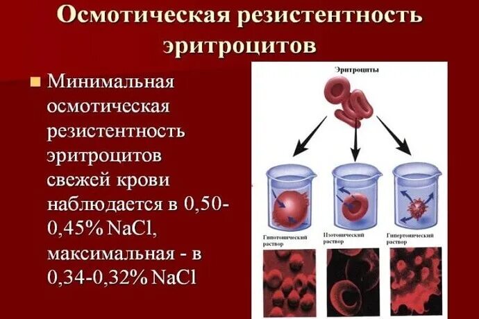 Скорость определения эритроцитов. Изучение осмотической резистентности эритроцитов. осмотическая резистентность эритроцитов при анемии. осмотическая устойчивость эритроцитов физиология. осмотическая резистентность в норме.